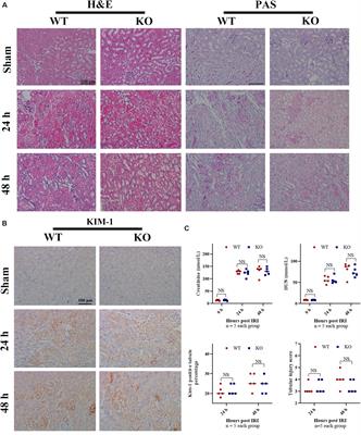 Depletion of Toll-Like Receptor-9 Attenuates Renal Tubulointerstitial Fibrosis After Ischemia-Reperfusion Injury